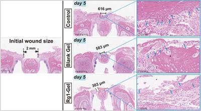 In situ photo-crosslinked hydrogel promotes oral mucosal wound healing through sustained delivery of ginsenoside Rg1